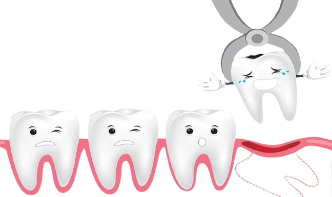 Bước 4: Tiến hành nhổ răng