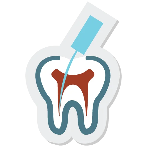 Bước 5: Trám bít ống tuỷ