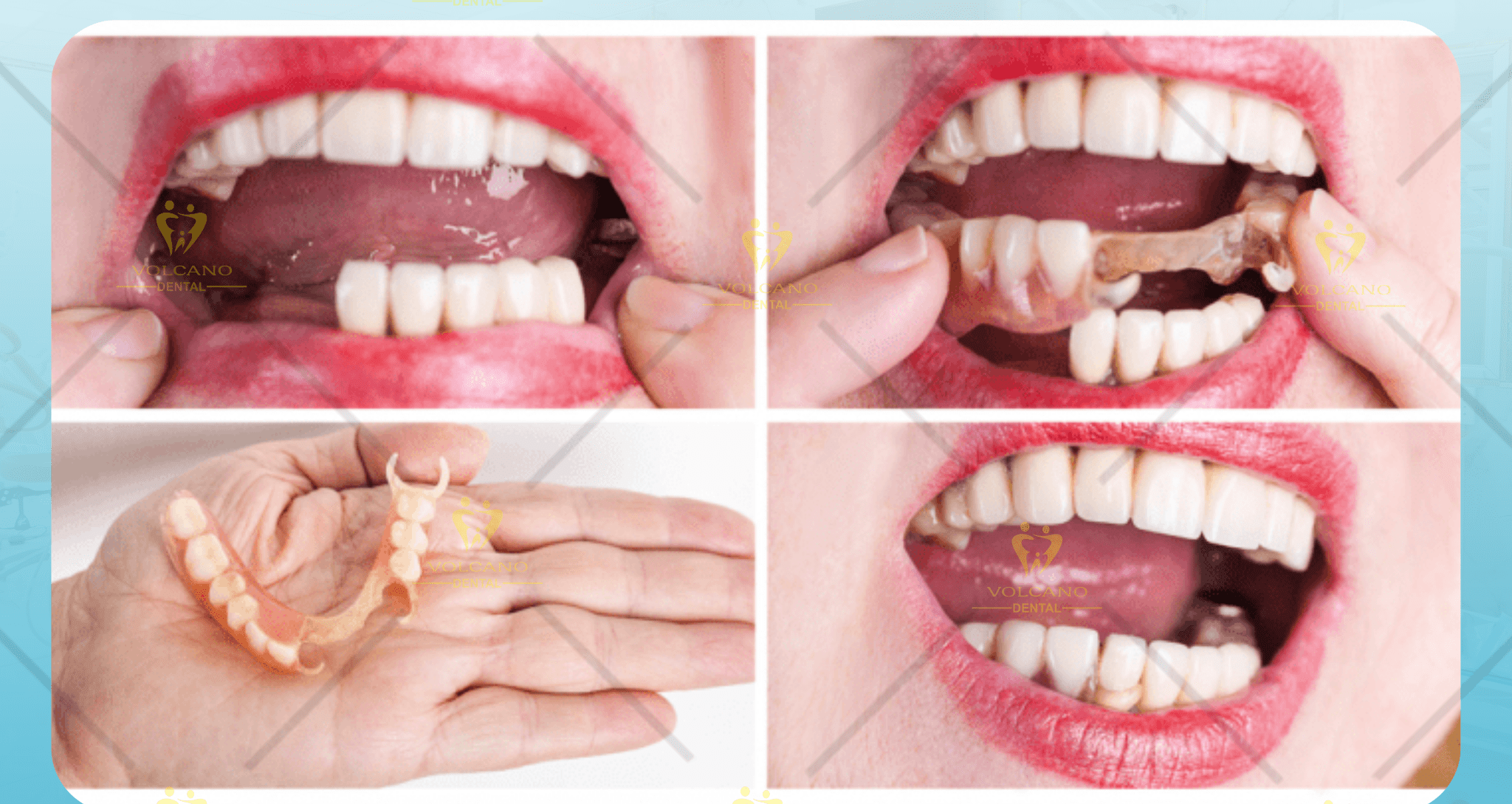 Bước 3: Tiến hành vệ sinh răng miệng