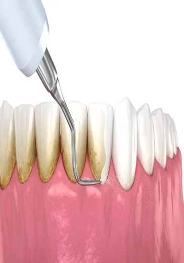 Trước điều trị