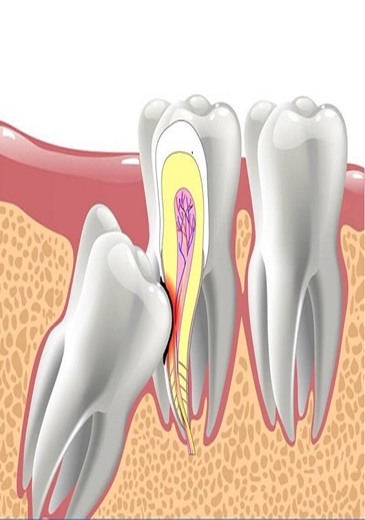 Trước điều trị